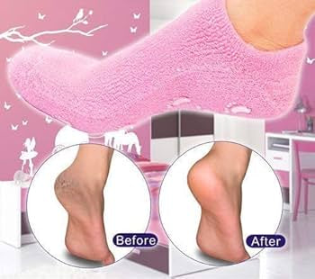 شرابات جل سيليكون للرجال والنساء - مخصص للعناية بالقدمين وترطيبها - لوقاية القدم وعلاج الكعبين والاقدام الجافة والمتشققة
