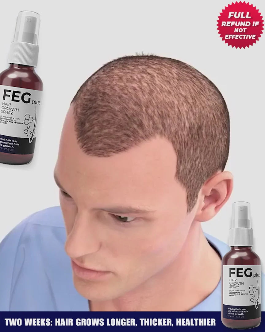FEG Hair Growth Spray | بخاخ طبيعي لتقوية ونمو الشعر بسرعة