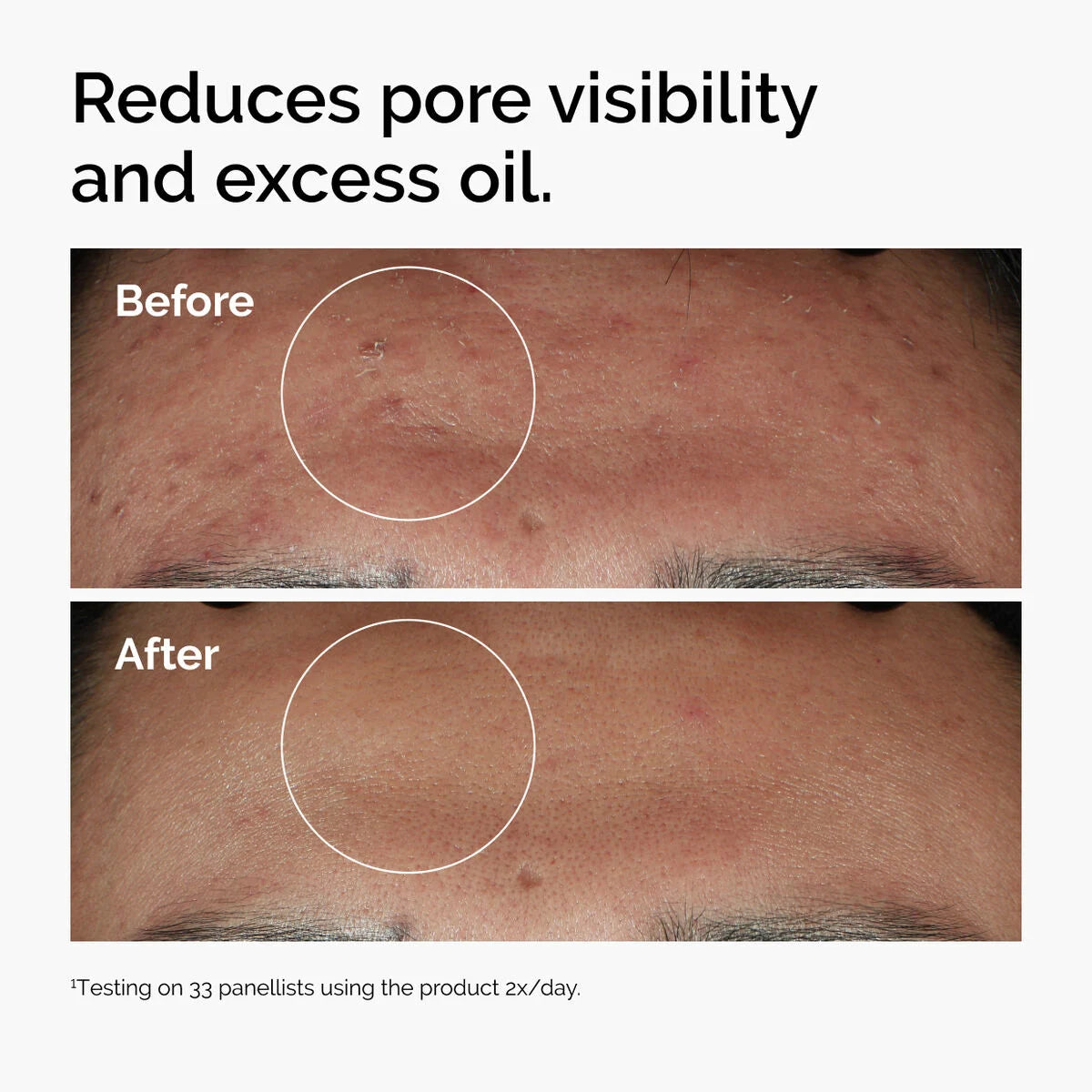 The Ordinary Niacinamide 10% + Zinc 1% | توازن الدهون وتحسين مظهر البشرة