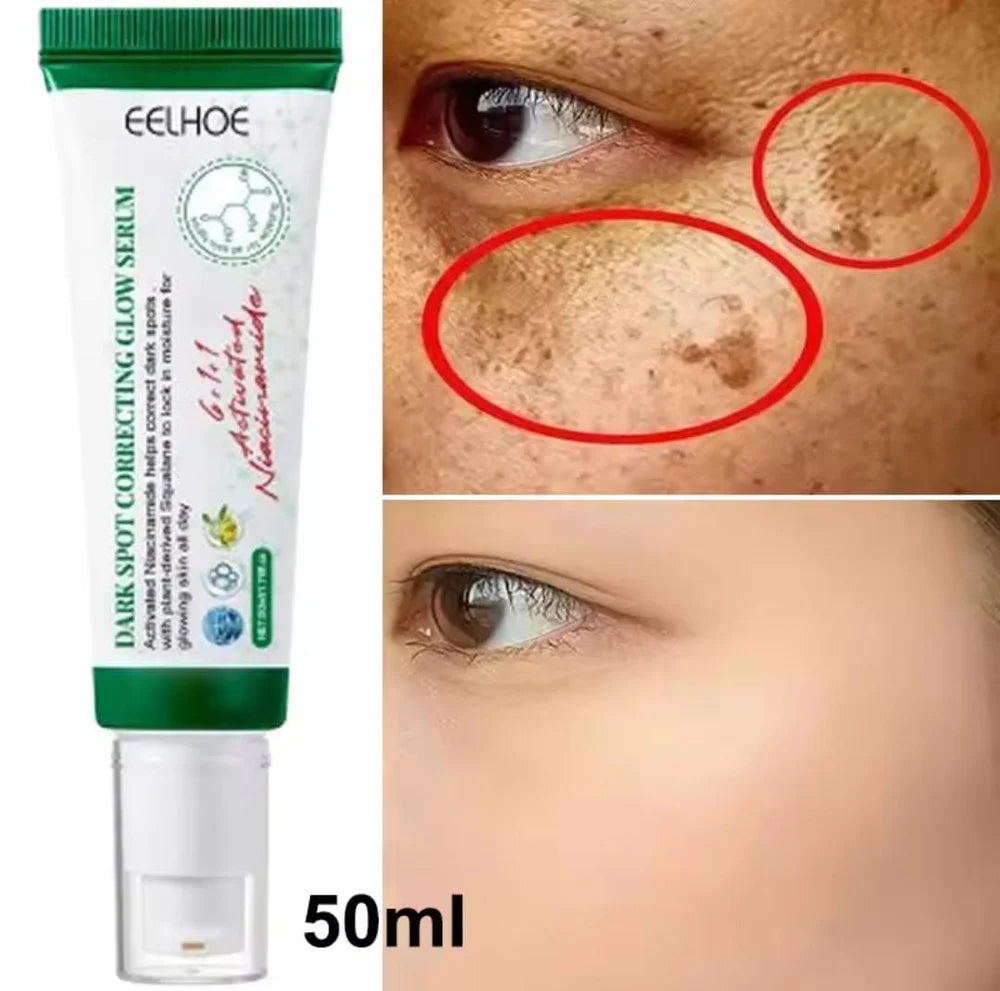 سيروم Dark Spot Correcting Glow | EELHOE لتصحيح البقع الداكنة | إشراقة وترطيب للبشرة