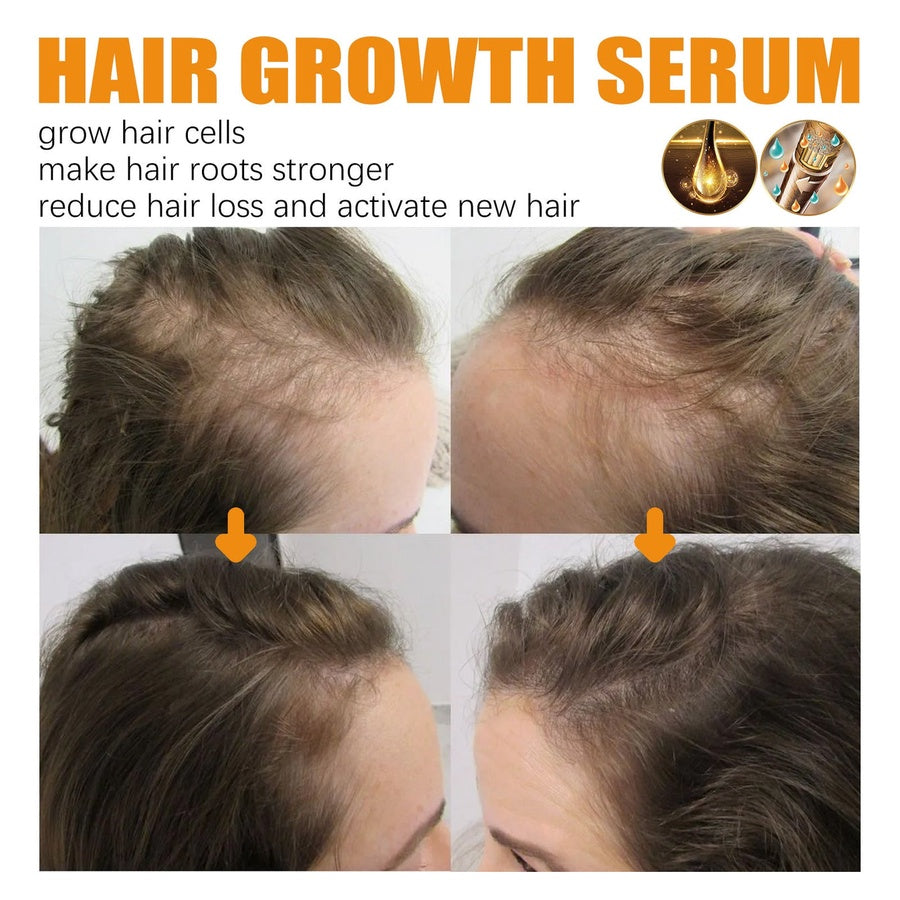 EELHOE Biotin Hair Spray | بخاخ البيوتين للعناية بالشعر وتعزيز مظهر الكثافة