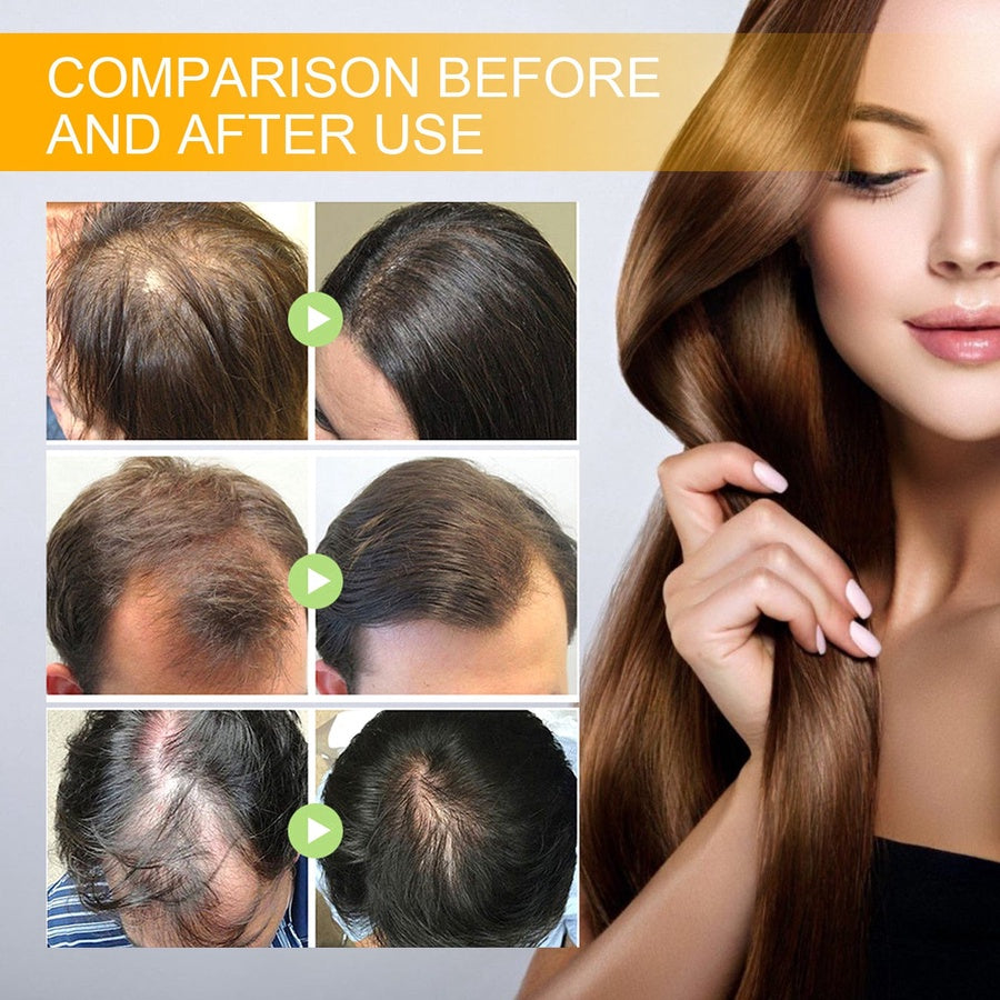 EELHOE Biotin Hair Spray | بخاخ البيوتين للعناية بالشعر وتعزيز مظهر الكثافة