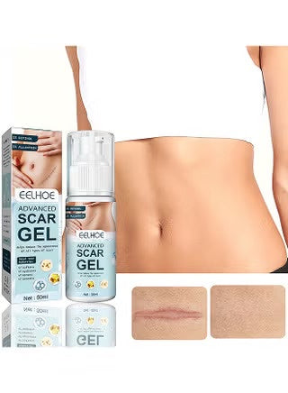EELHOE Advanced Scar Gel | جل للعناية بآثار الندوب وتحسين مظهر البشرة