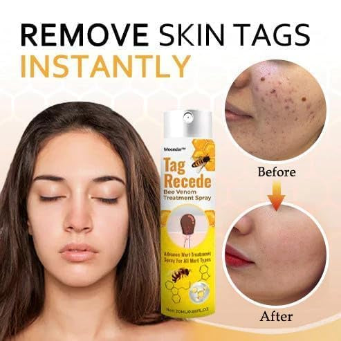 Ximonth Beesvenom Wart Care Spray | بخاخ للعناية بالبشرة وتحسين مظهر الزوائد الجلدية