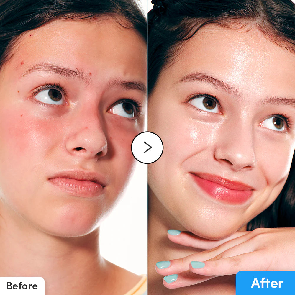 Eqqual Berry Hyaltoin Flooding Serum | سيروم ترطيب مكثف وتقوية حاجز البشرة