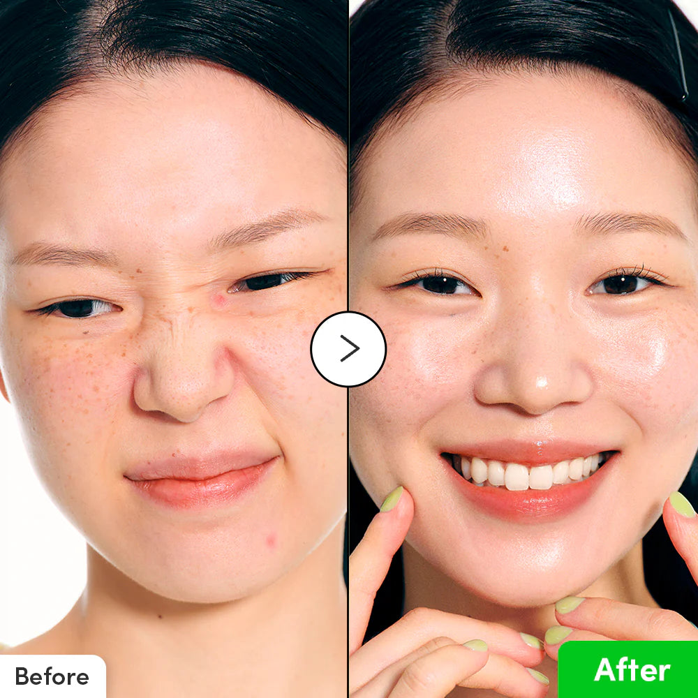 Eqqualberry Aloe PDRN Calming Serum | سيروم مهدئ لترطيب البشرة ودعم حاجزها