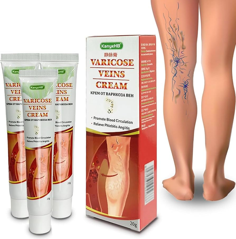 KanyeHB Varicose Veins Cream | كريم للعناية بالساقين وتحسين مظهر الدوالي