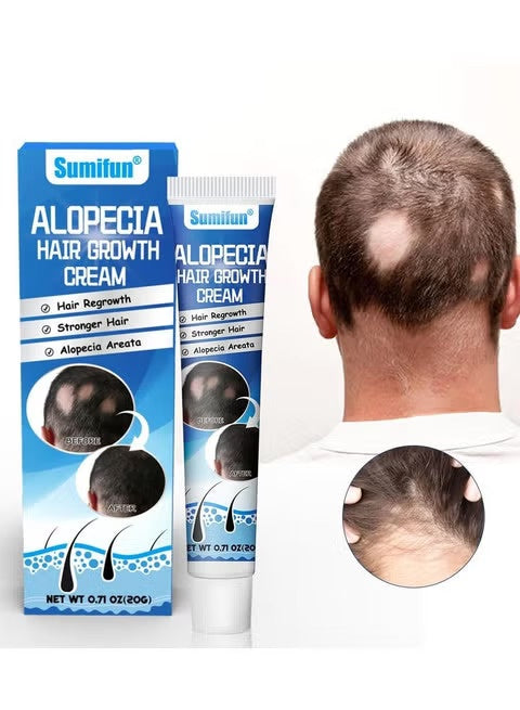 Sumifun Alopecia Hair Growth Cream | كريم العناية بالشعر وتحسين مظهر الكثافة