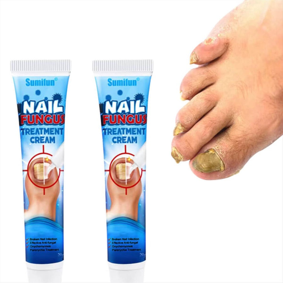 Sumifun Nail Fungus Cream | كريم العناية بالأظافر وتحسين مظهرها