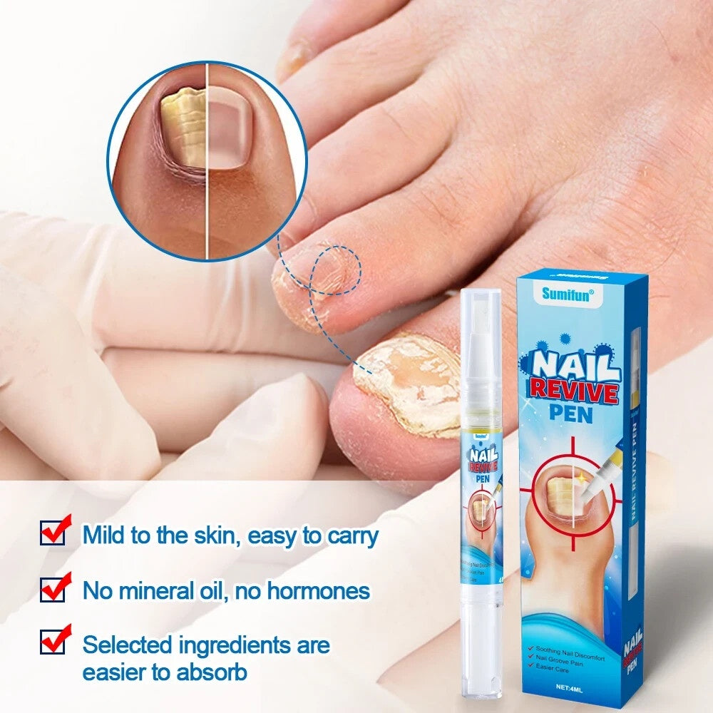 Sumifun Nail Fungus Cream | كريم العناية بالأظافر وتحسين مظهرها